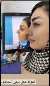 Screenshot_۲۰۲۴۱۲۲۲_۱۱۳۱۱۵_Instagram